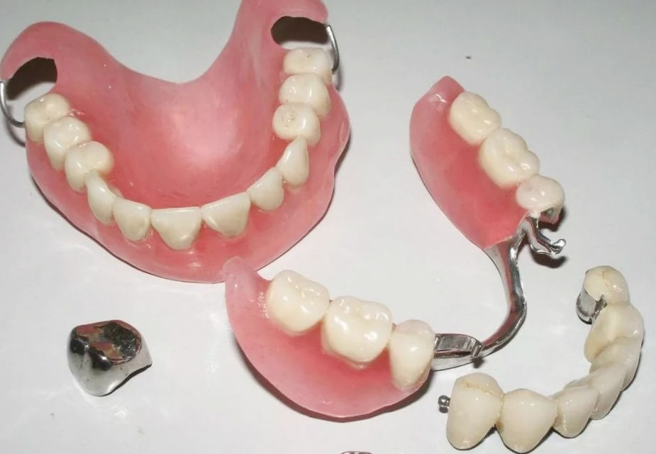 Стоматология расценки на протезирование зубов Наращивание зубов Томск Анжерский